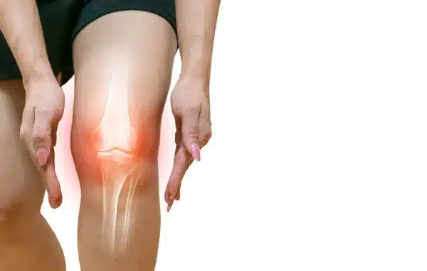 A woman is holding her knee with pain.